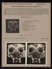 Vertical Transverse Bilateral Section - no. 9